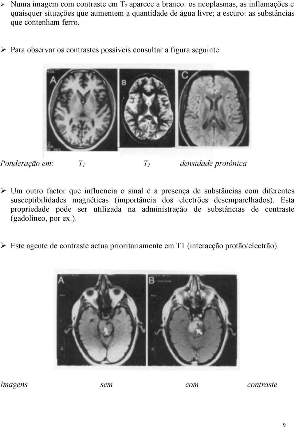 Para observar os contrastes possíveis consultar a figura seguinte: Ponderação em: T 1 T 2 densidade protónica Um outro factor que influencia o sinal é a presença de