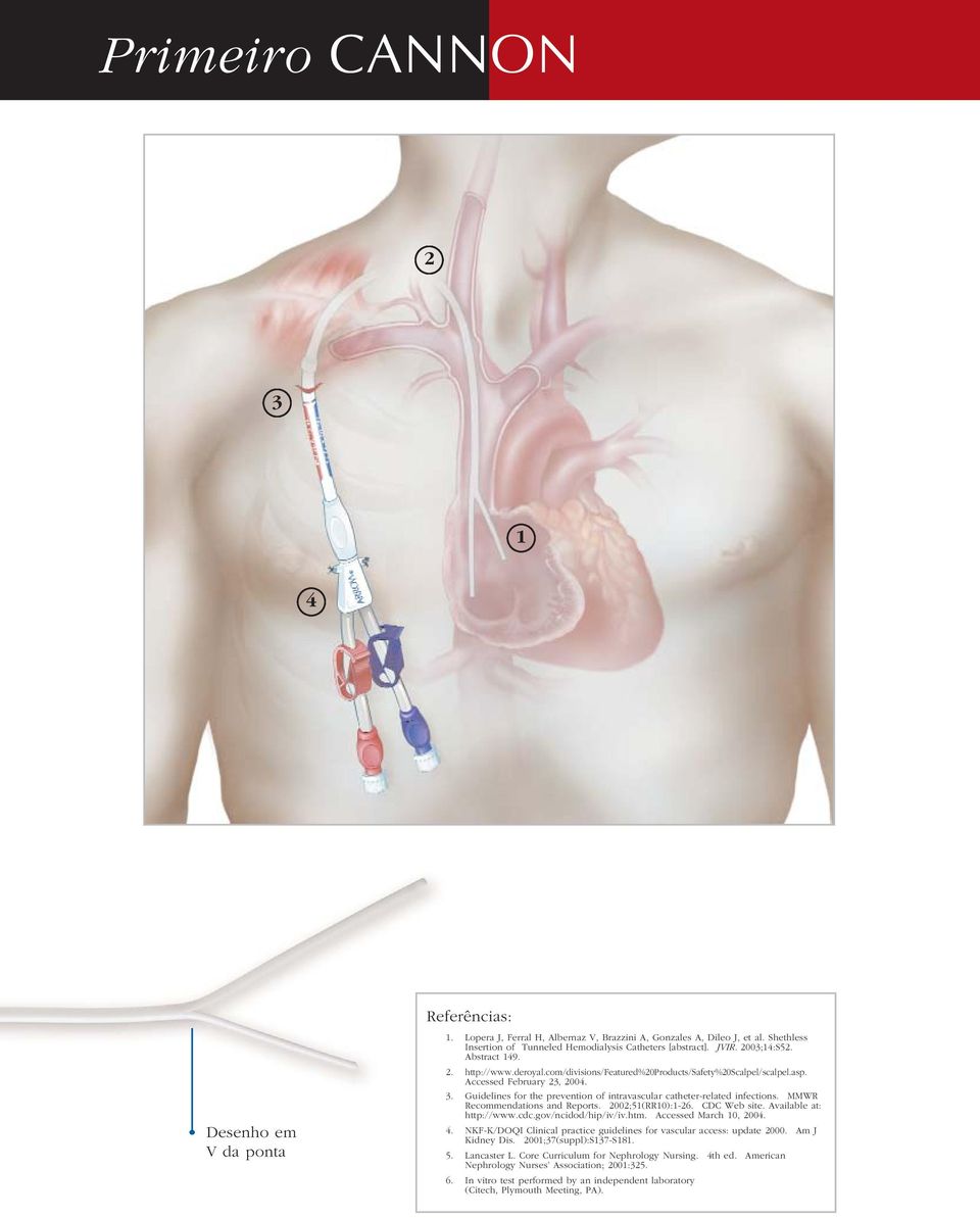 Guidelines for the prevention of intravascular catheter-related infections. MMWR Recommendations and Reports. 2002;51(RR10):1-26. CDC Web site. Available at: http://www.cdc.gov/ncidod/hip/iv/iv.htm.
