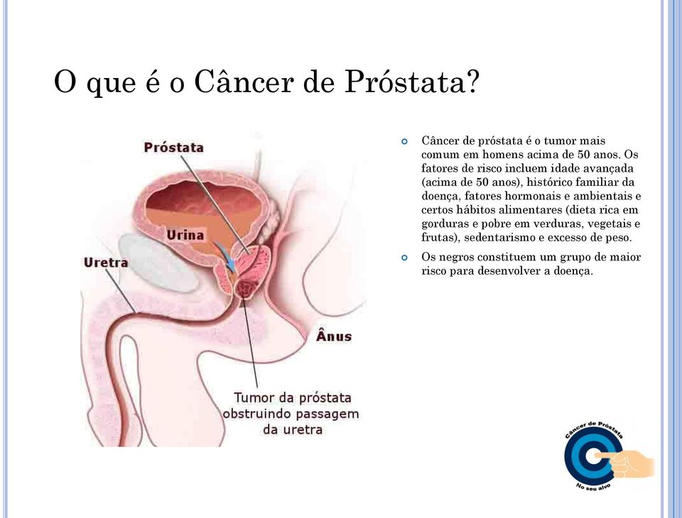 hormonais e ambientais e certos hábitos alimentares (dieta rica em gorduras e pobre em verduras,