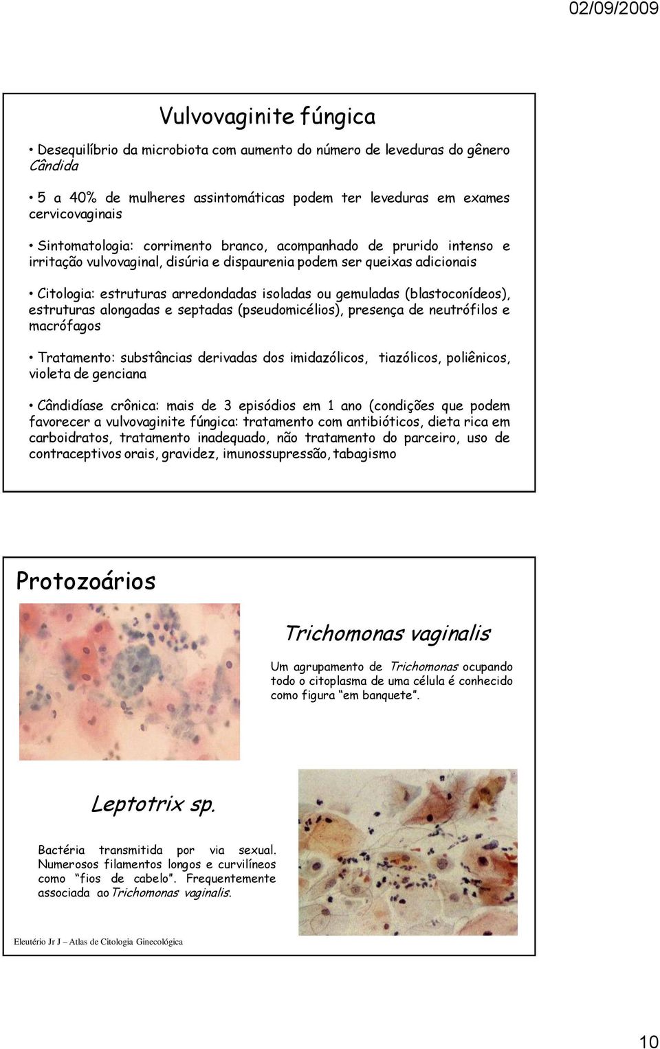 (blastoconídeos), estruturas alongadas e septadas (pseudomicélios), presença de neutrófilos e macrófagos Tratamento: substâncias derivadas dos imidazólicos, violeta de genciana tiazólicos,