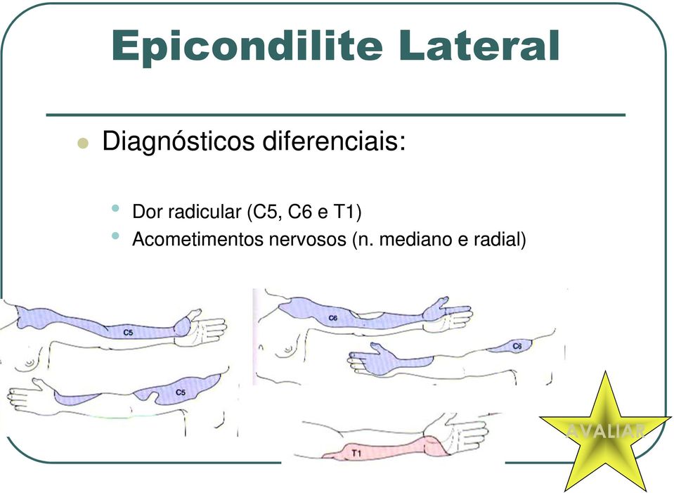 radicular (C5, C6 e T1)
