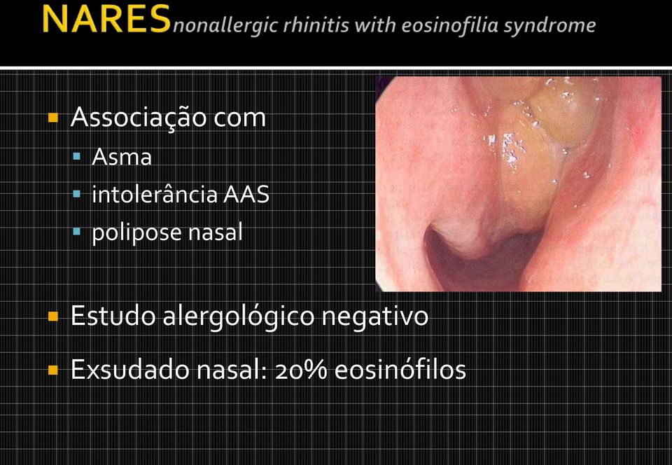 nasal Estudo alergológico