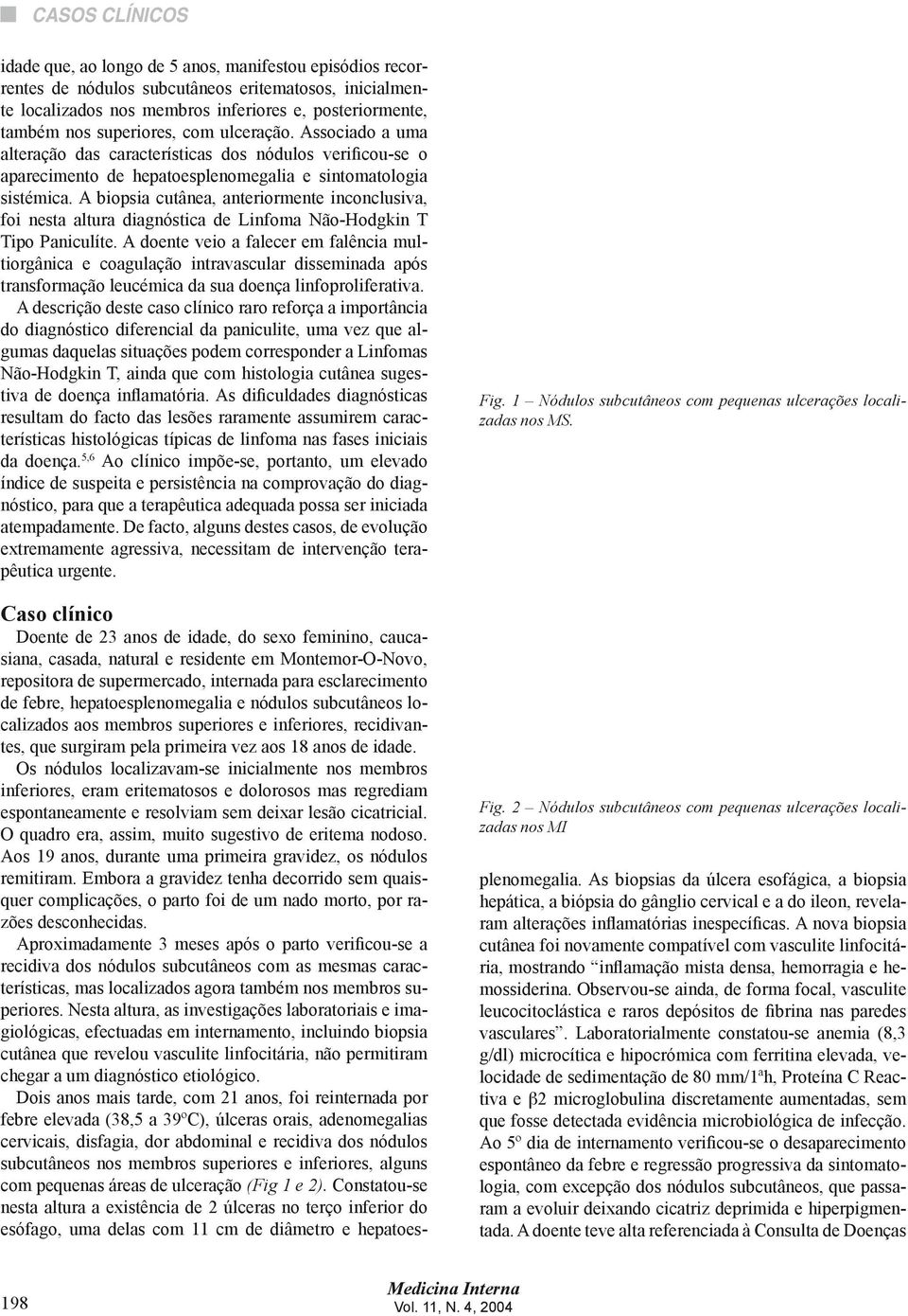 A biopsia cutânea, anteriormente inconclusiva, foi nesta altura diagnóstica de Linfoma Não-Hodgkin T Tipo Paniculíte.