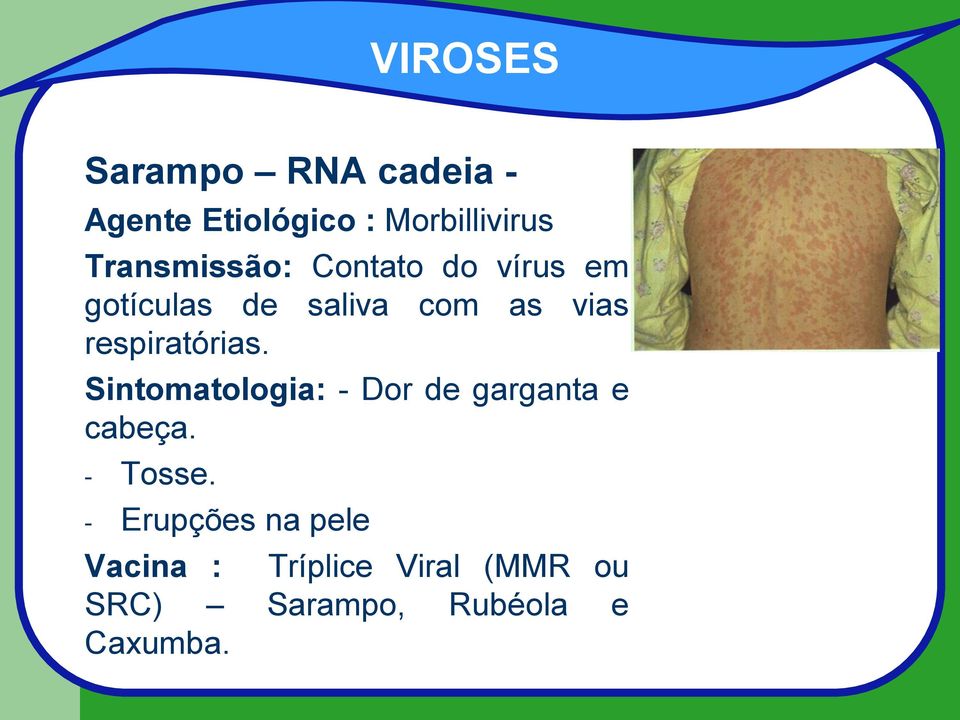 Sintomatologia: - Dor de garganta e cabeça. - Tosse.