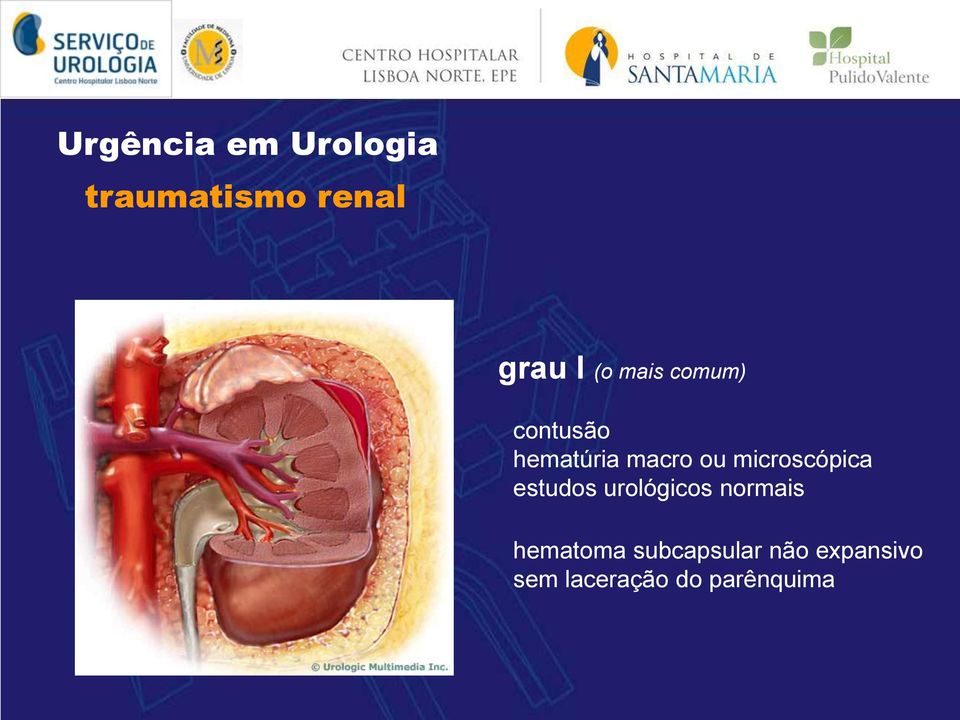 estudos urológicos normais hematoma