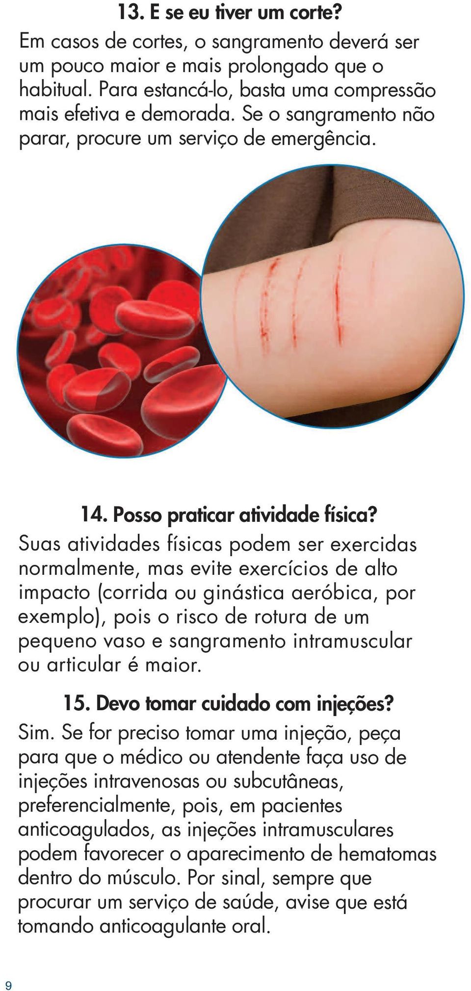 Suas atividades físicas podem ser exercidas normalmente, mas evite exercícios de alto impacto (corrida ou ginástica aeróbica, por exemplo), pois o risco de rotura de um pequeno vaso e sangramento