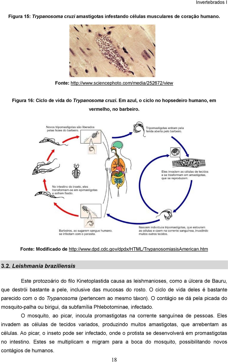 Leishmania braziliensis Este protozoário do filo Kinetoplastida causa as leishmanioses, como a úlcera de Bauru, que destrói bastante a pele, inclusive das mucosas do rosto.