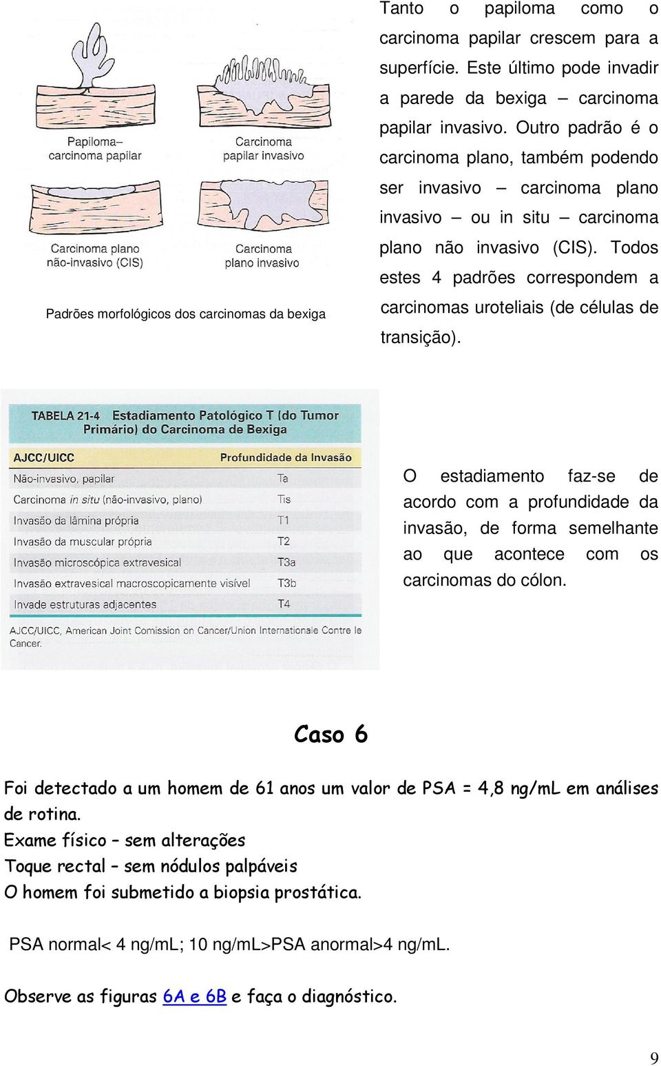 Todos estes 4 padrões correspondem a Padrões morfológicos dos carcinomas da bexiga carcinomas uroteliais (de células de transição).