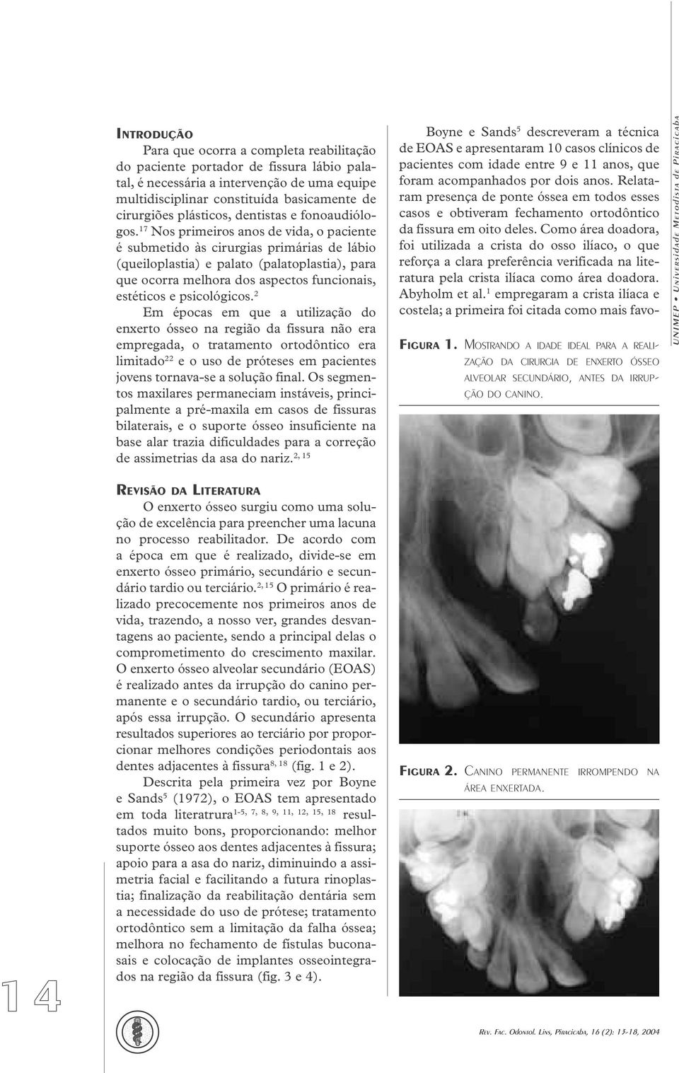 17 Nos primeiros anos de vida, o paciente é submetido às cirurgias primárias de lábio (queiloplastia) e palato (palatoplastia), para que ocorra melhora dos aspectos funcionais, estéticos e