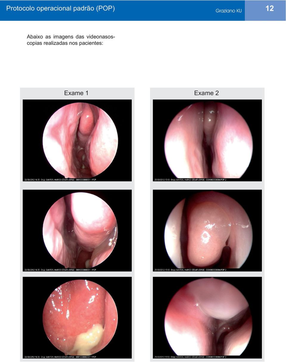 Graziano KU 12 Abaixo as imagens das