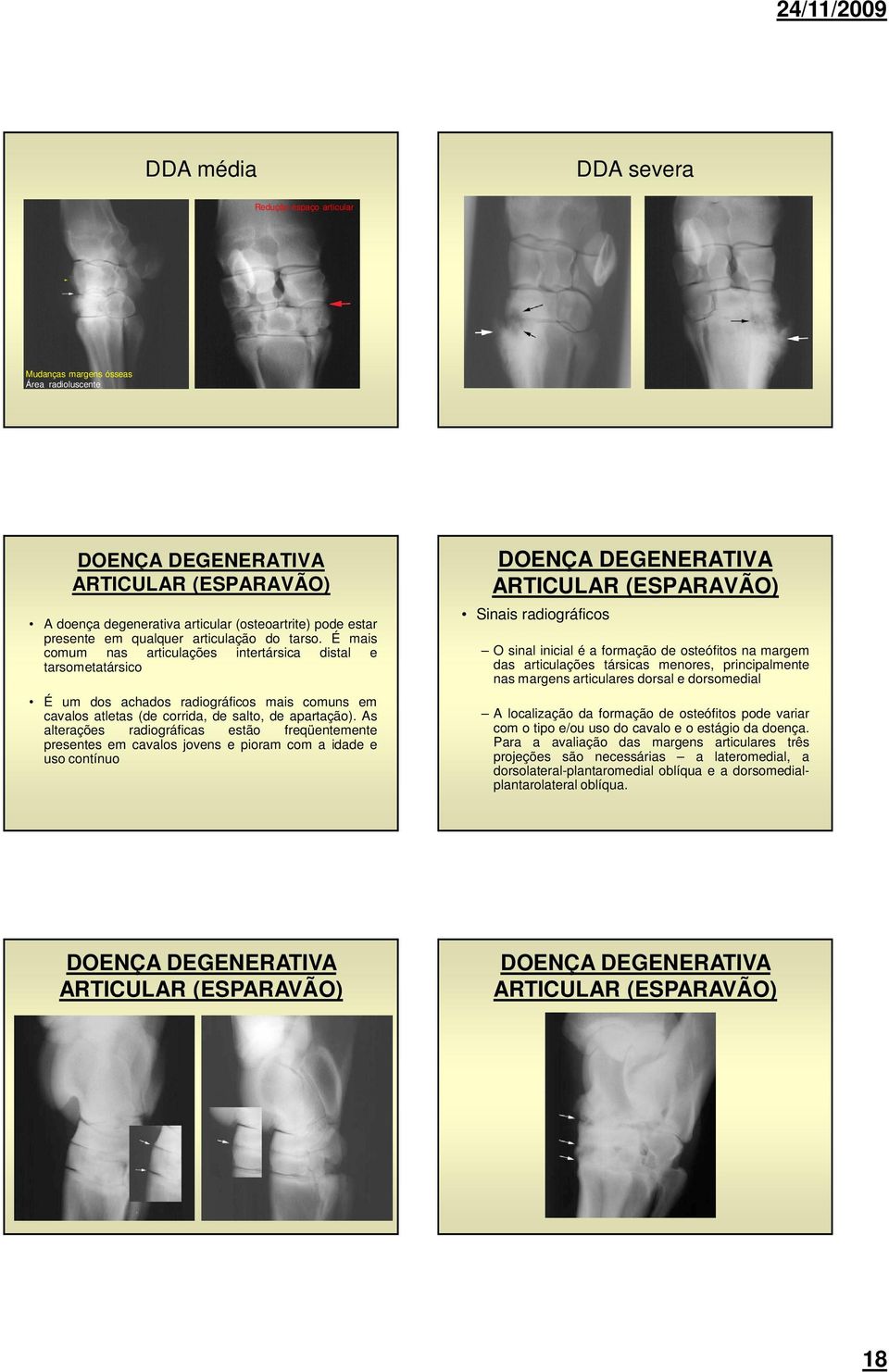 É mais comum nas articulações intertársica distal e tarsometatársico É um dos achados radiográficos mais comuns em cavalos atletas (de corrida, de salto, de apartação).