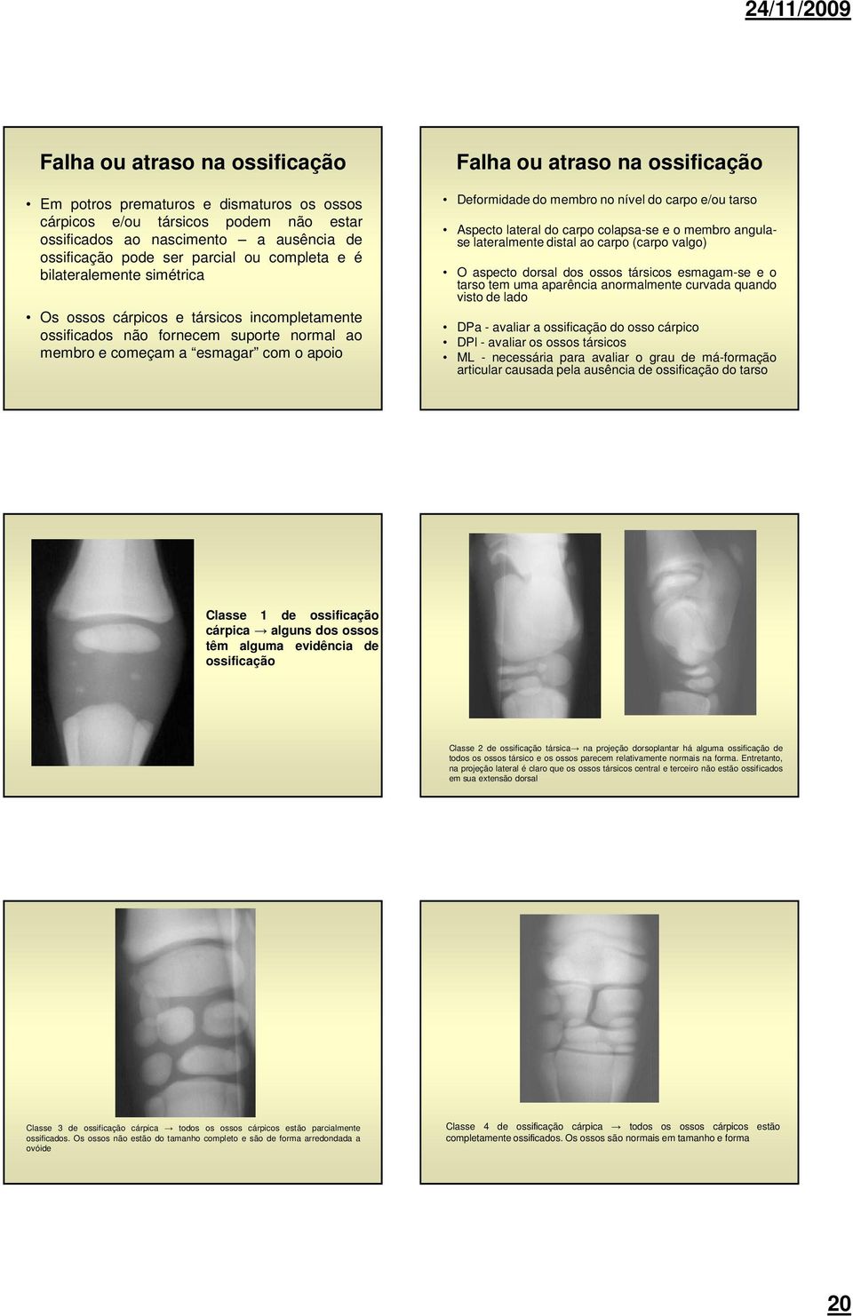 membro no nível do carpo e/ou tarso Aspecto lateral do carpo colapsa-se e o membro angulase lateralmente distal ao carpo (carpo valgo) O aspecto dorsal dos ossos társicos esmagam-se e o tarso tem uma