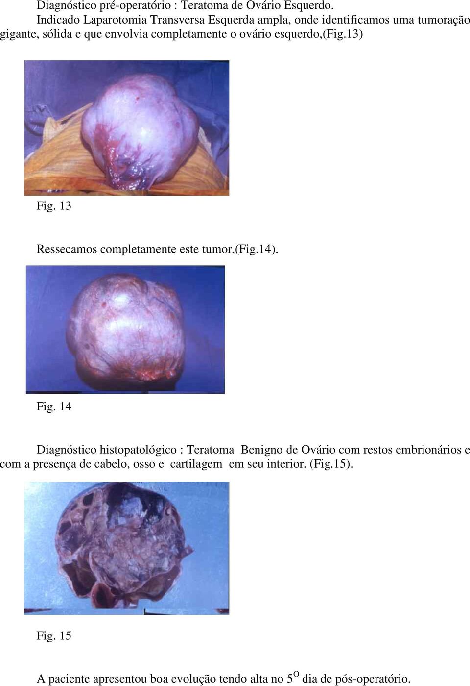 ovário esquerdo,(fig.13) Fig.