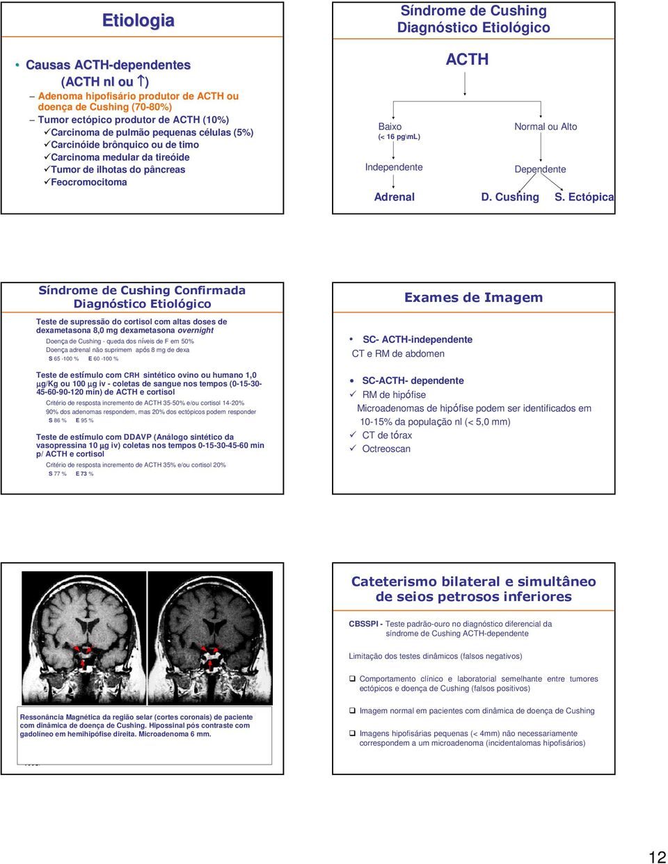 Alto Dependente Adrenal D. Cushing S.