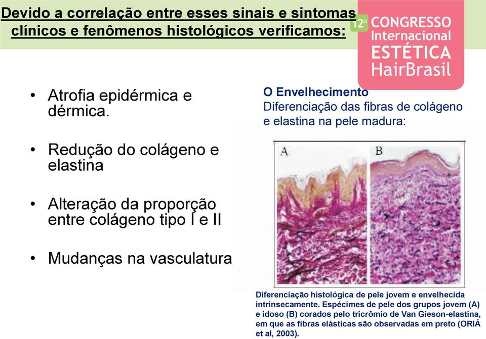 das fibras de colágeno e elastina na pele madura: Diferenciação histológica de pele jovem e envelhecida intrinsecamente.