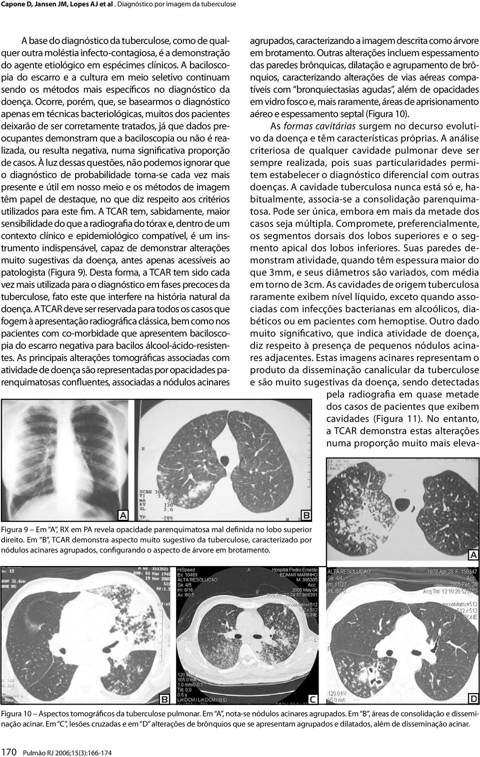 Ocorre, porém, que, se basearmos o diagnóstico apenas em técnicas bacteriológicas, muitos dos pacientes deixarão de ser corretamente tratados, já que dados preocupantes demonstram que a baciloscopia