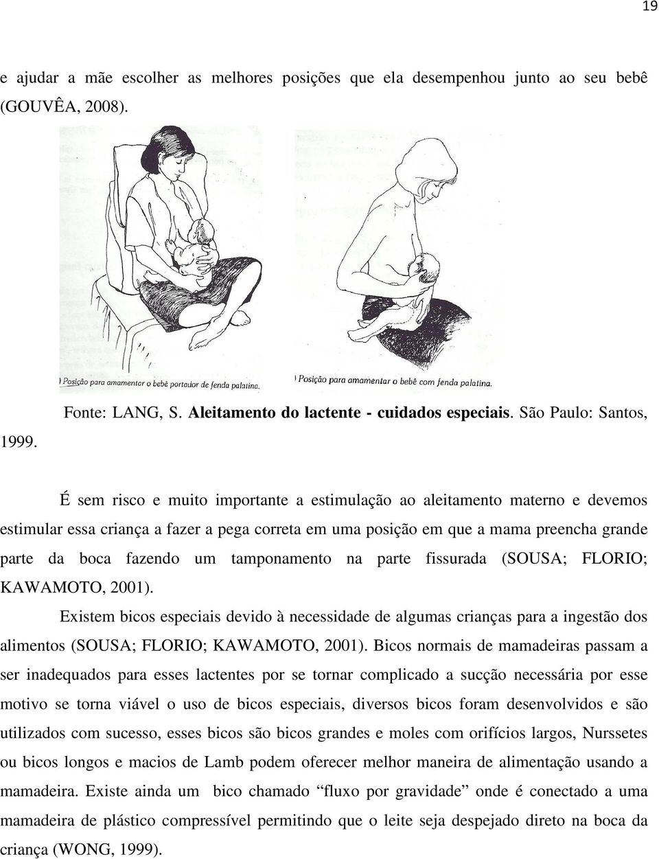 boca fazendo um tamponamento na parte fissurada (SOUSA; FLORIO; KAWAMOTO, 2001).
