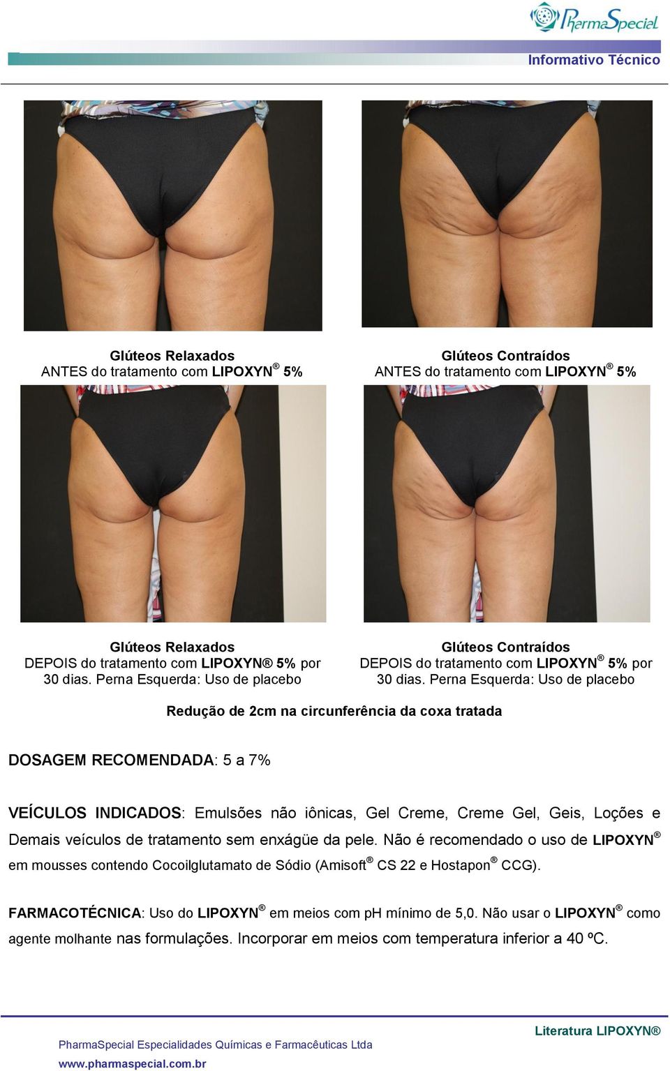 Perna Esquerda: Uso de placebo Redução de 2cm na circunferência da coxa tratada DOSAGEM RECOMENDADA: 5 a 7% VEÍCULOS INDICADOS: Emulsões não iônicas, Gel Creme, Creme Gel, Geis, Loções e Demais