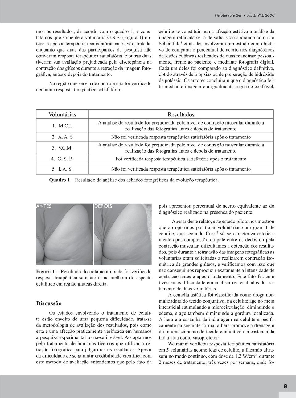 avaliação prejudicada pela discrepância na contração dos glúteos durante a retração da imagem fotográfica, antes e depois do tratamento.