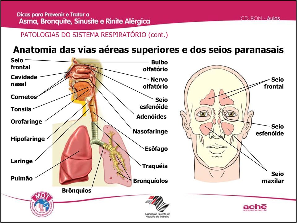 nasal Cornetos Tonsila Orofaringe Hipofaringe Bulbo olfatório Nervo olfatório Seio