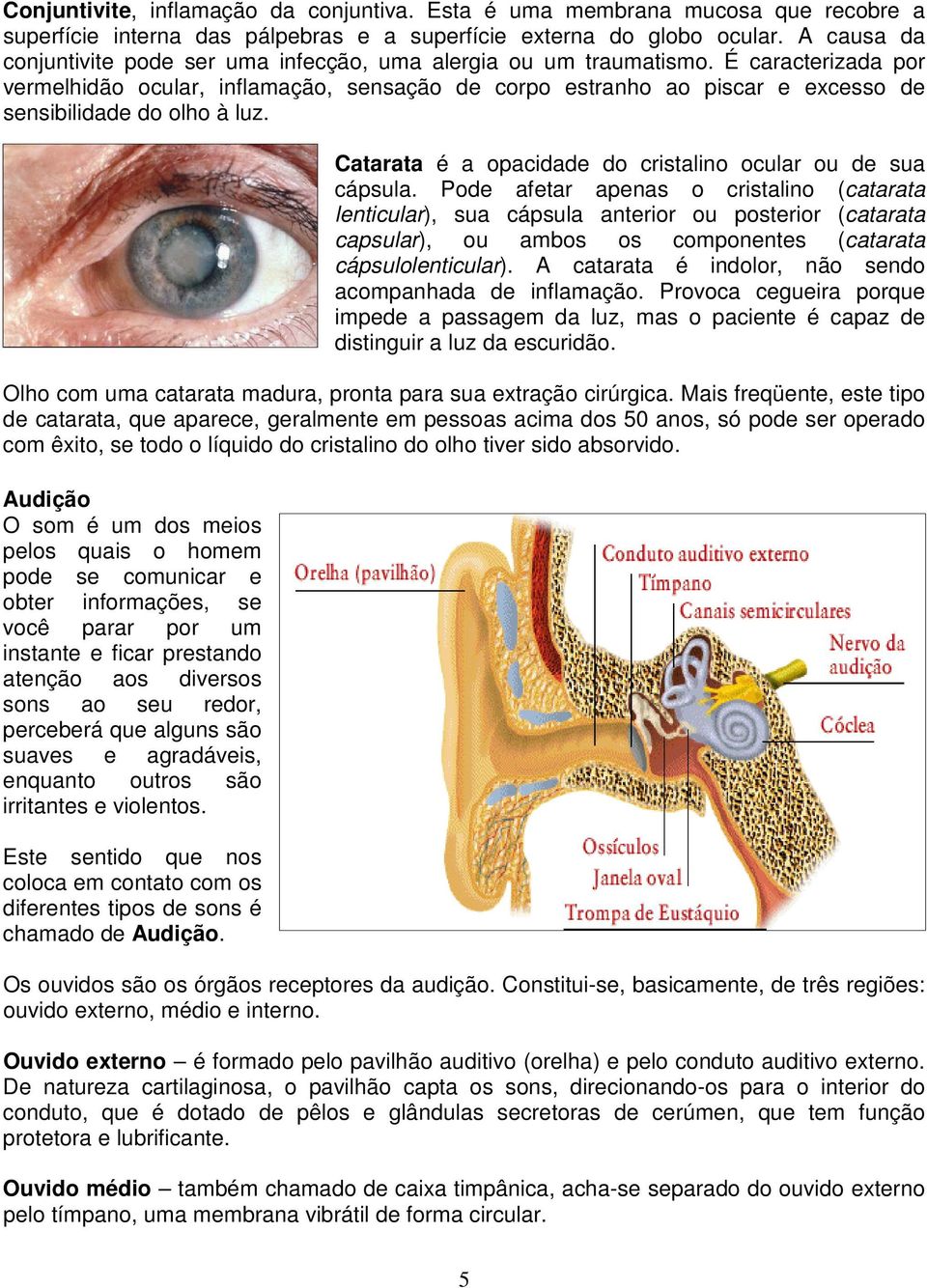 É caracterizada por vermelhidão ocular, inflamação, sensação de corpo estranho ao piscar e excesso de sensibilidade do olho à luz. Catarata é a opacidade do cristalino ocular ou de sua cápsula.