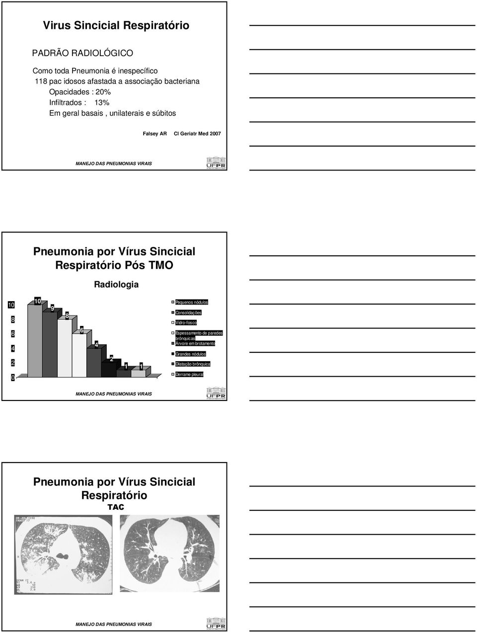 Sincicial Respiratório Pós TMO Radiologia 10 8 6 4 2 0 10 9 8 6 4 2 1 1 Pequenos nódulos Consolidações Vidro-fosco Espessamento de