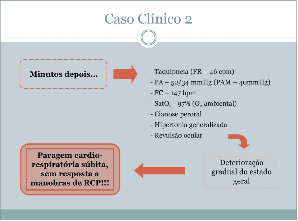 - Hipertonia generalizada - Revulsão ocular Paragem cardiorespiratória