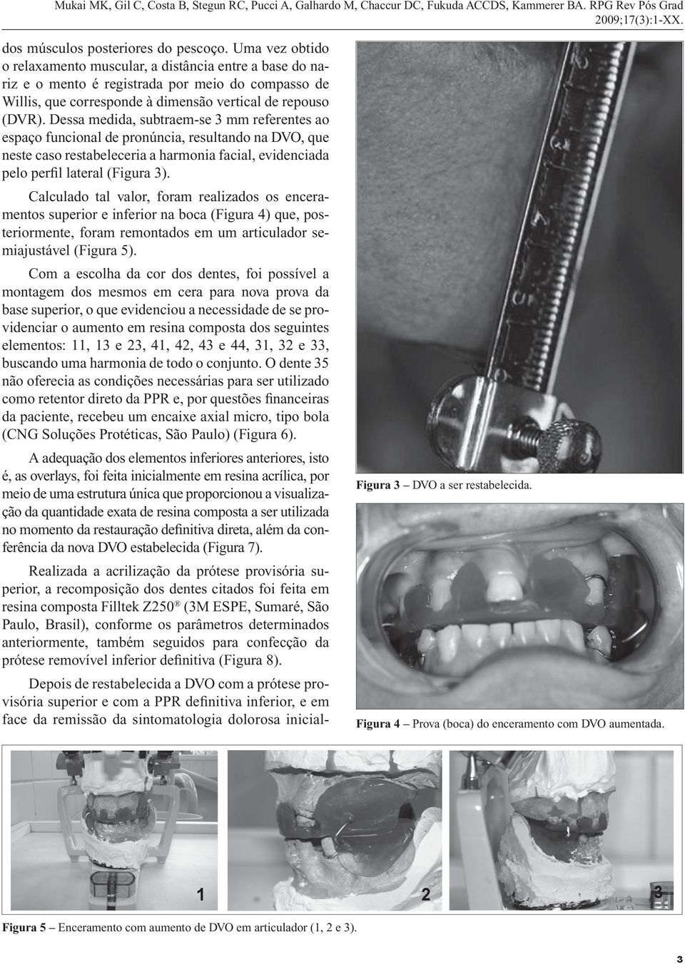 Dessa medida, subtraem-se 3 mm referentes ao espaço funcional de pronúncia, resultando na DVO, que neste caso restabeleceria a harmonia facial, evidenciada pelo perfil lateral (Figura 3).