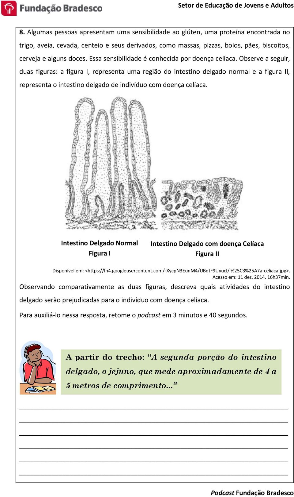 Observe a seguir, duas figuras: a figura I, representa uma região do intestino delgado normal e a figura II, representa o intestino delgado de indivíduo com doença celíaca.