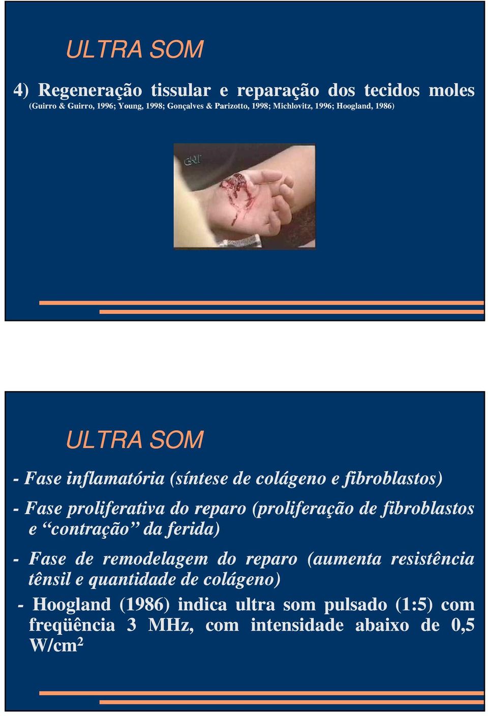 (proliferação de fibroblastos e contração da ferida) - Fase de remodelagem do reparo (aumenta resistência tênsil e