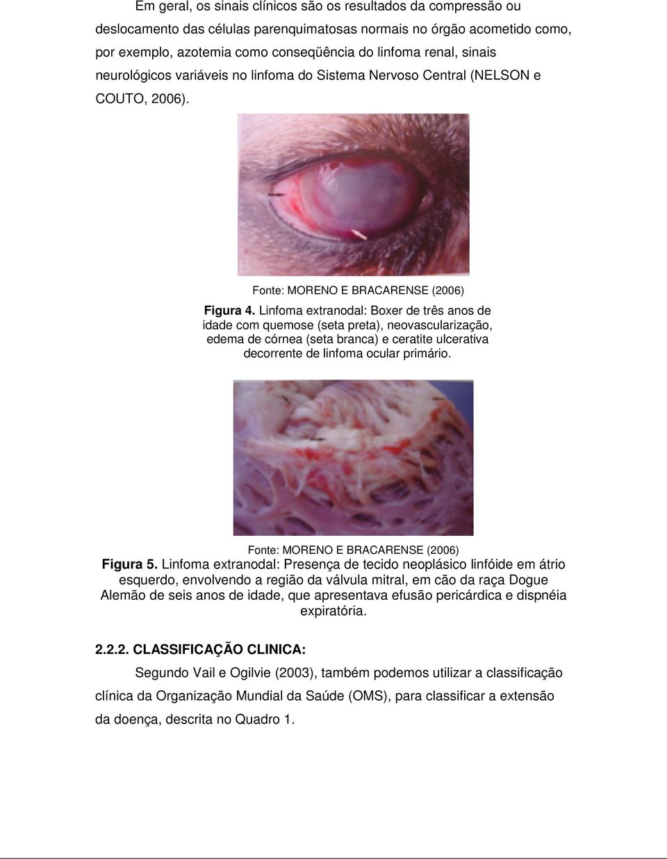 Linfoma extranodal: Boxer de três anos de idade com quemose (seta preta), neovascularização, edema de córnea (seta branca) e ceratite ulcerativa decorrente de linfoma ocular primário.