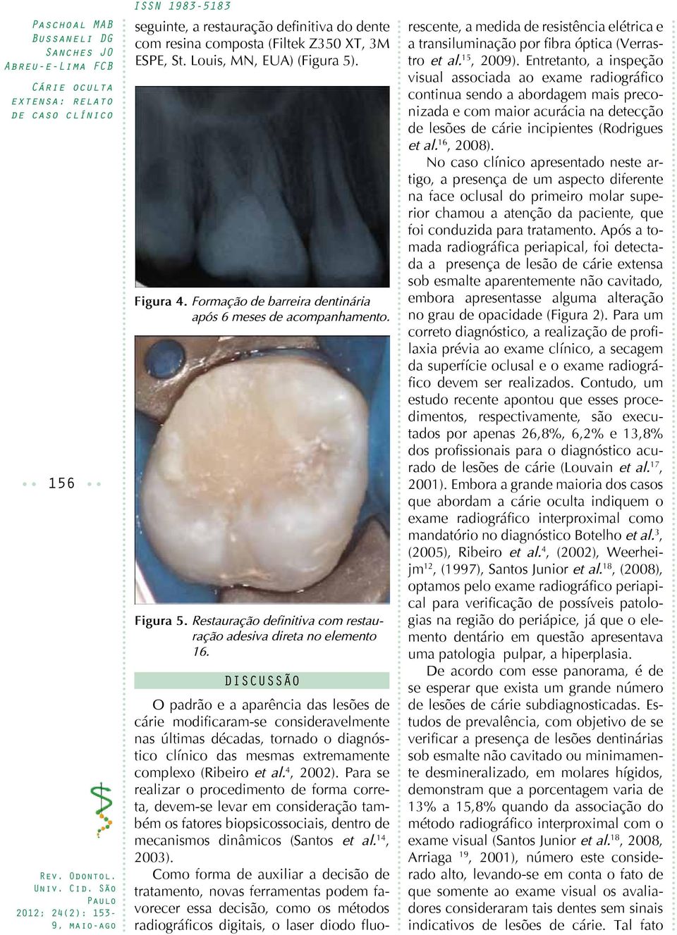 Como forma de auxiliar a decisão de tratamento, novas ferramentas podem favorecer essa decisão, como os métodos radiográficos digitais, o laser diodo fluo- seguinte, a restauração definitiva do dente