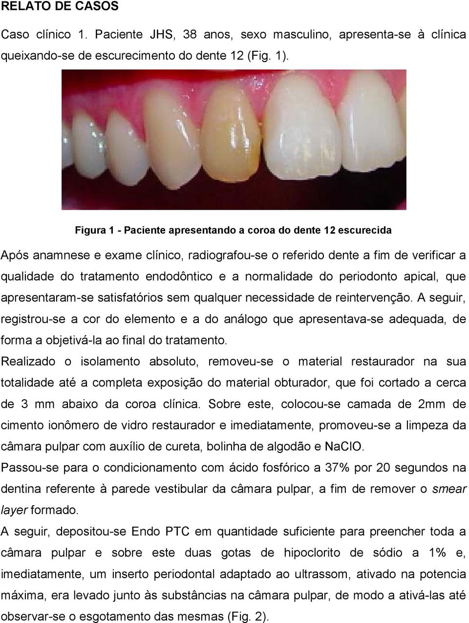 do periodonto apical, que apresentaram-se satisfatórios sem qualquer necessidade de reintervenção.