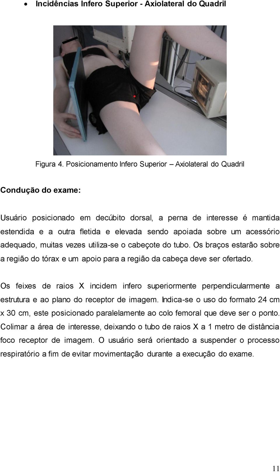 sobre um acessório adequado, muitas vezes utiliza-se o cabeçote do tubo. Os braços estarão sobre a região do tórax e um apoio para a região da cabeça deve ser ofertado.