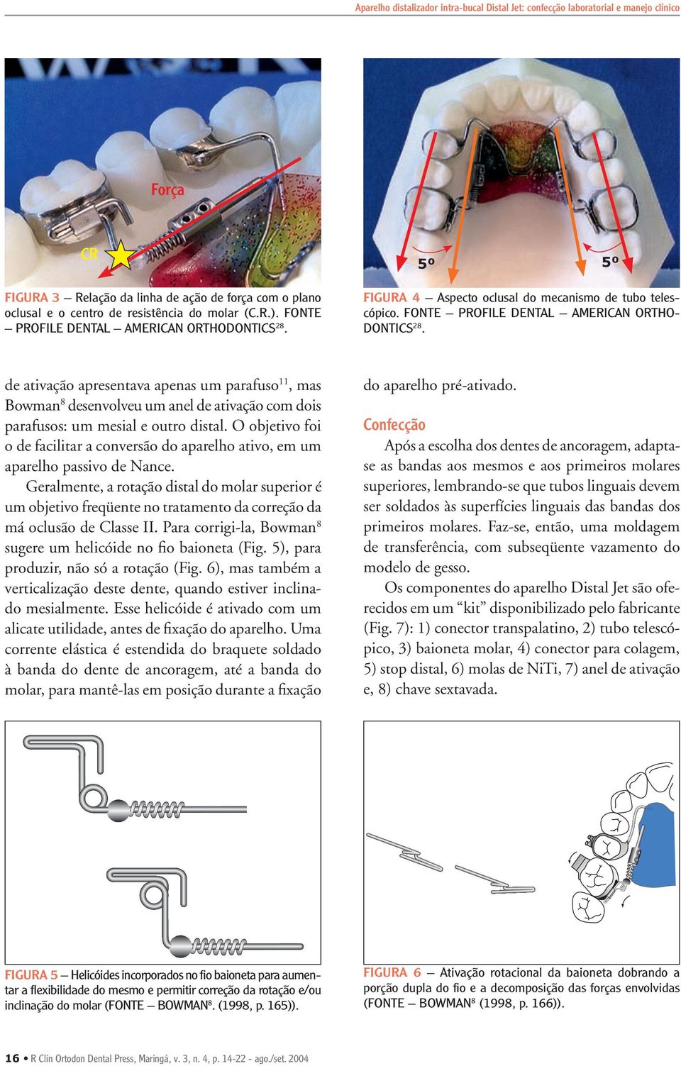 O objetivo foi o de facilitar a conversão do aparelho ativo, em um aparelho passivo de Nance.