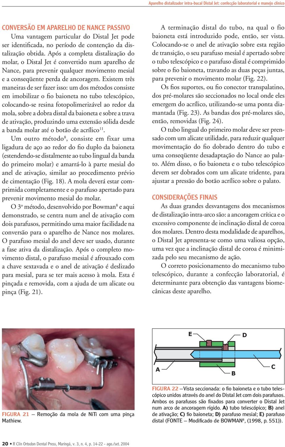 Existem três maneiras de ser fazer isso: um dos métodos consiste em imobilizar o fio baioneta no tubo telescópico, colocando-se resina fotopolimerizável ao redor da mola, sobre a dobra distal da