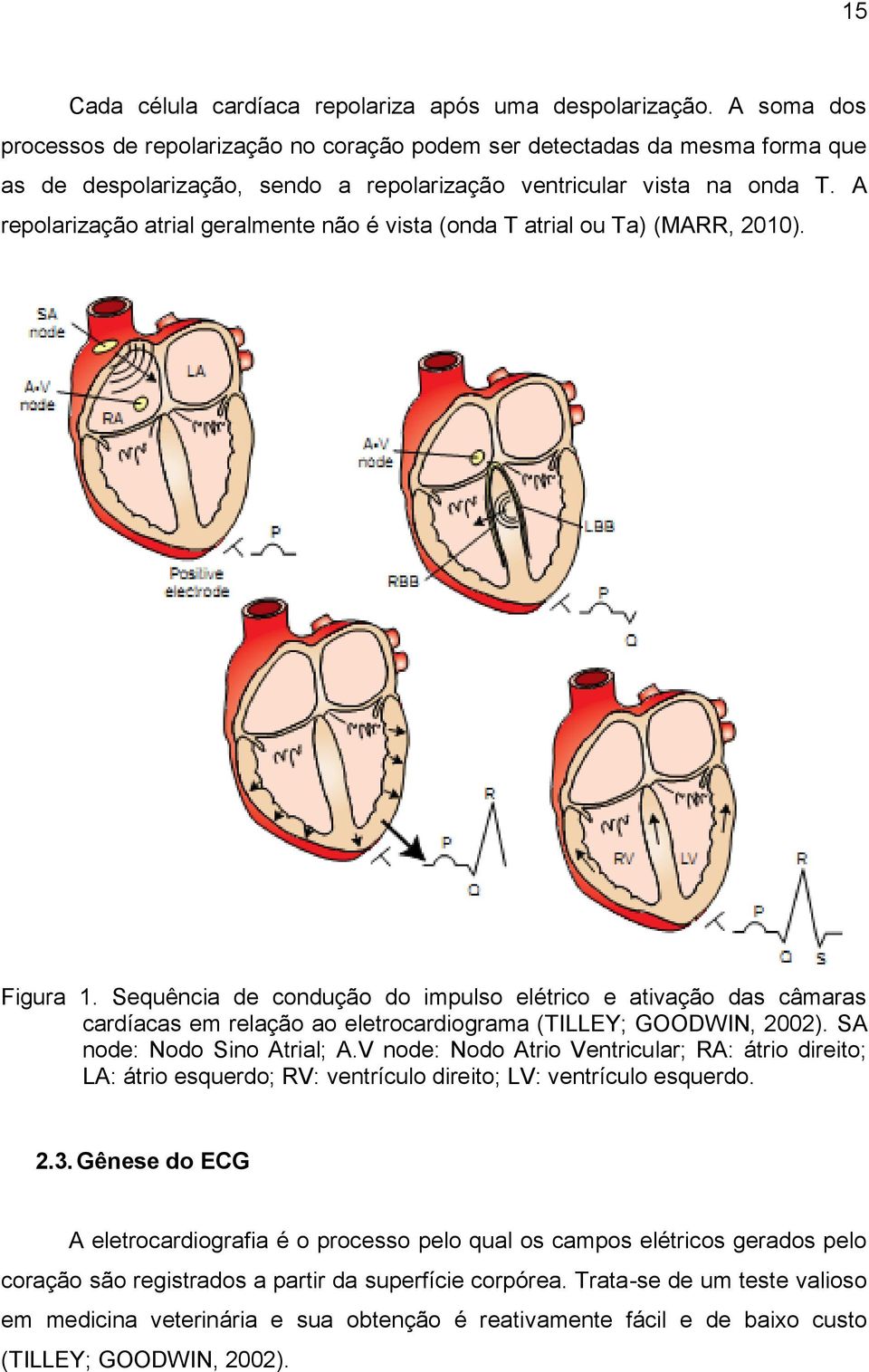 A repolarização atrial geralmente não é vista (onda T atrial ou Ta) (MARR, 2010). Figura 1.