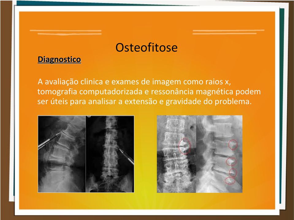 computadorizada e ressonância magnética podem