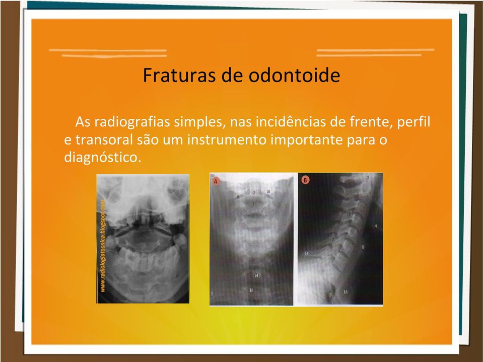 incidências de frente, perfil e