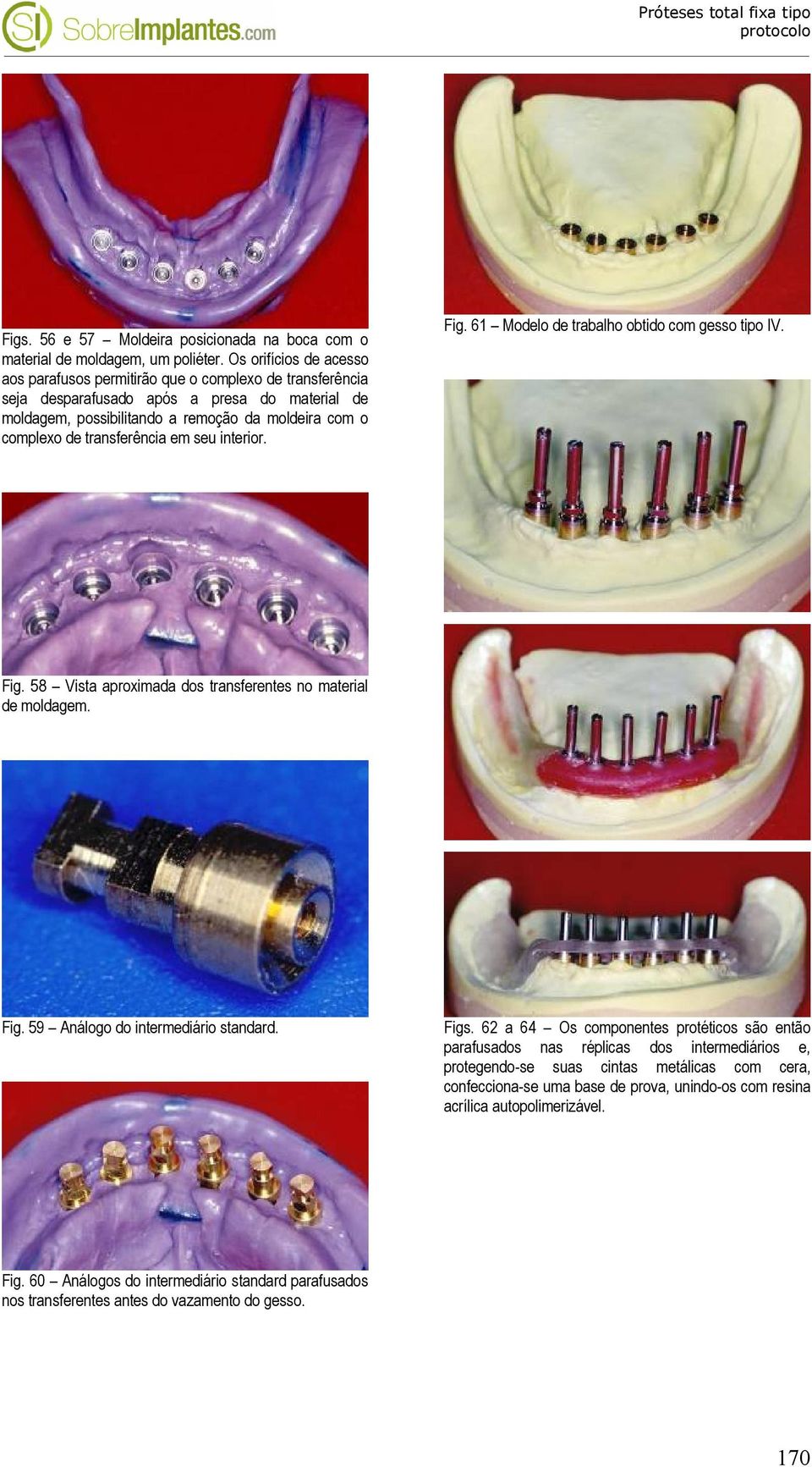 transferência em seu interior. Fig. 61 Modelo de trabalho obtido com gesso tipo IV. Fig. 58 Vista aproximada dos transferentes no material de moldagem. Fig. 59 Análogo do intermediário standard. Figs.