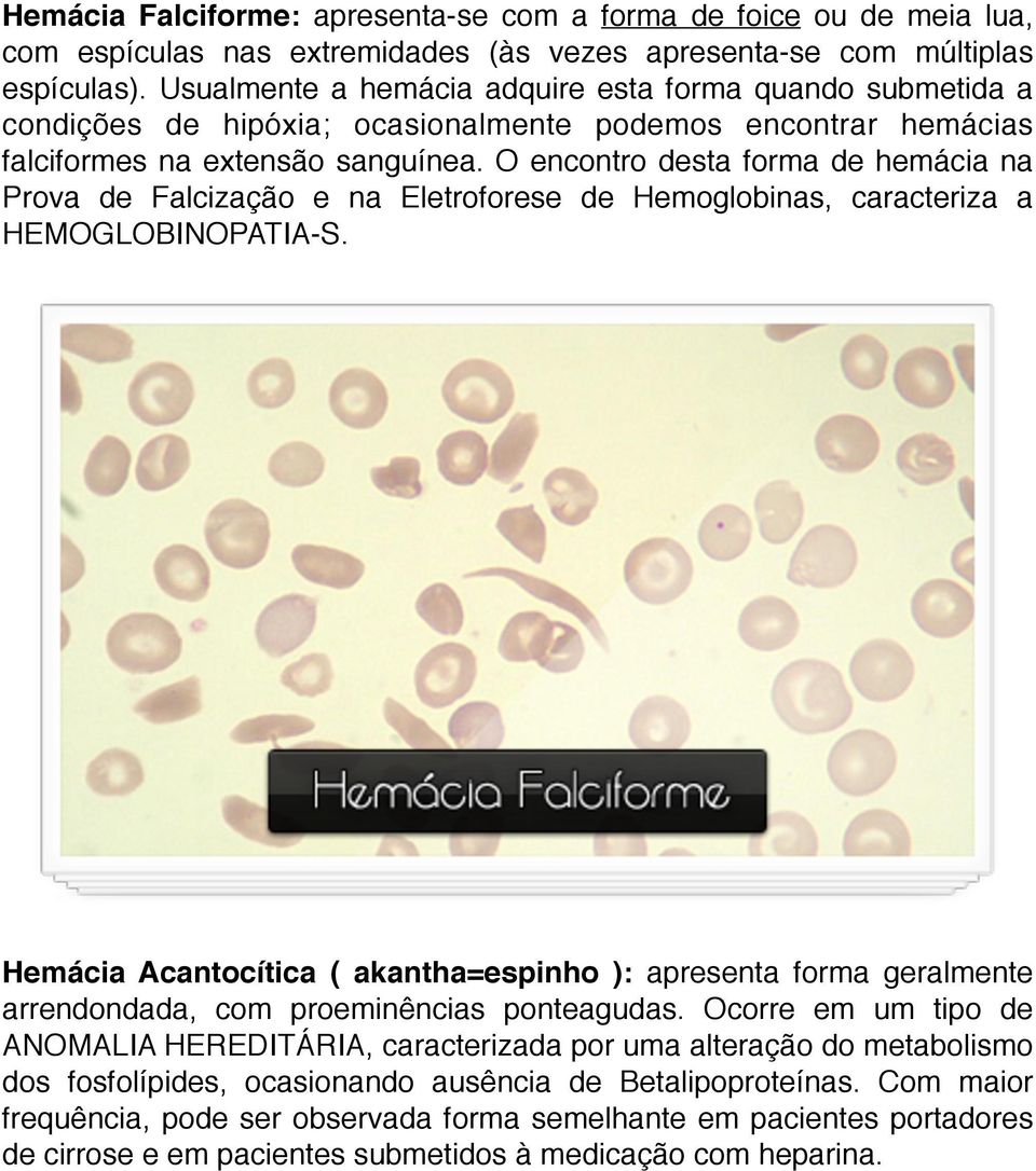 O encontro desta forma de hemácia na Prova de Falcização e na Eletroforese de Hemoglobinas, caracteriza a HEMOGLOBINOPATIA-S.