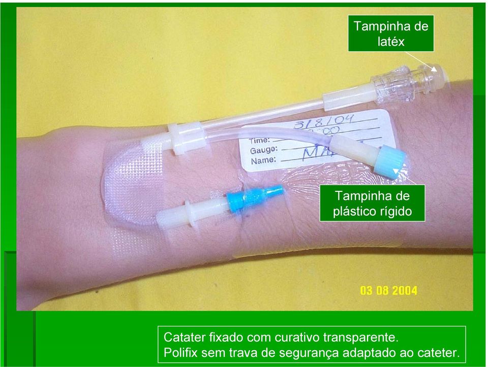 curativo transparente.