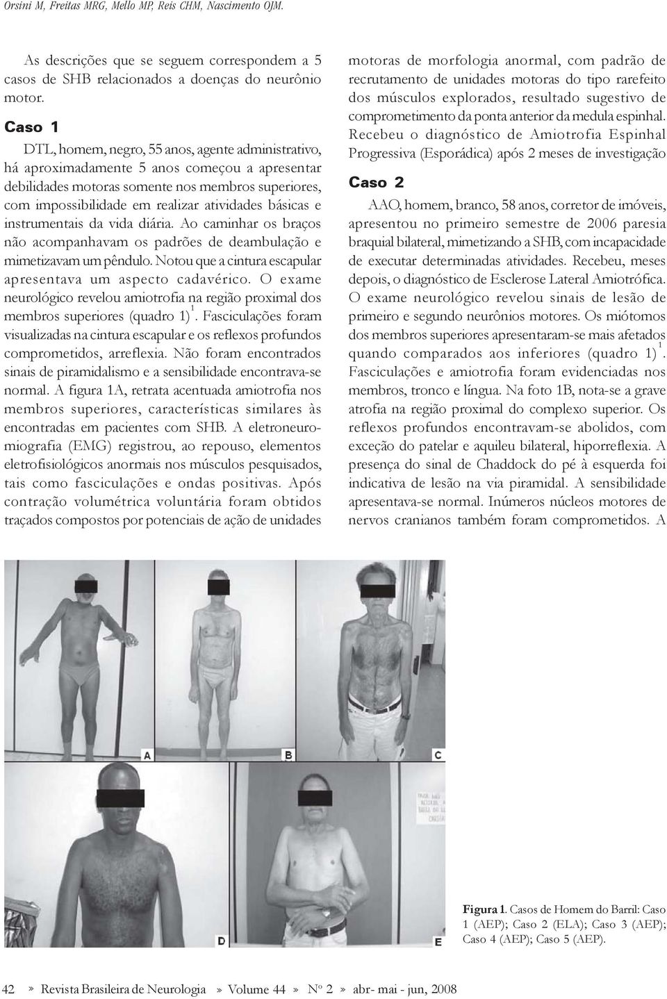 básicas e instrumentais da vida diária. Ao caminhar os braços não acompanhavam os padrões de deambulação e mimetizavam um pêndulo. Notou que a cintura escapular apresentava um aspecto cadavérico.