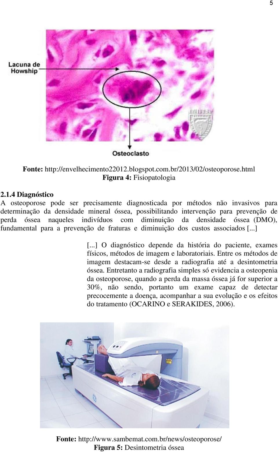 /02/osteoporose.html Figura 4: Fisiopatologia 2.1.