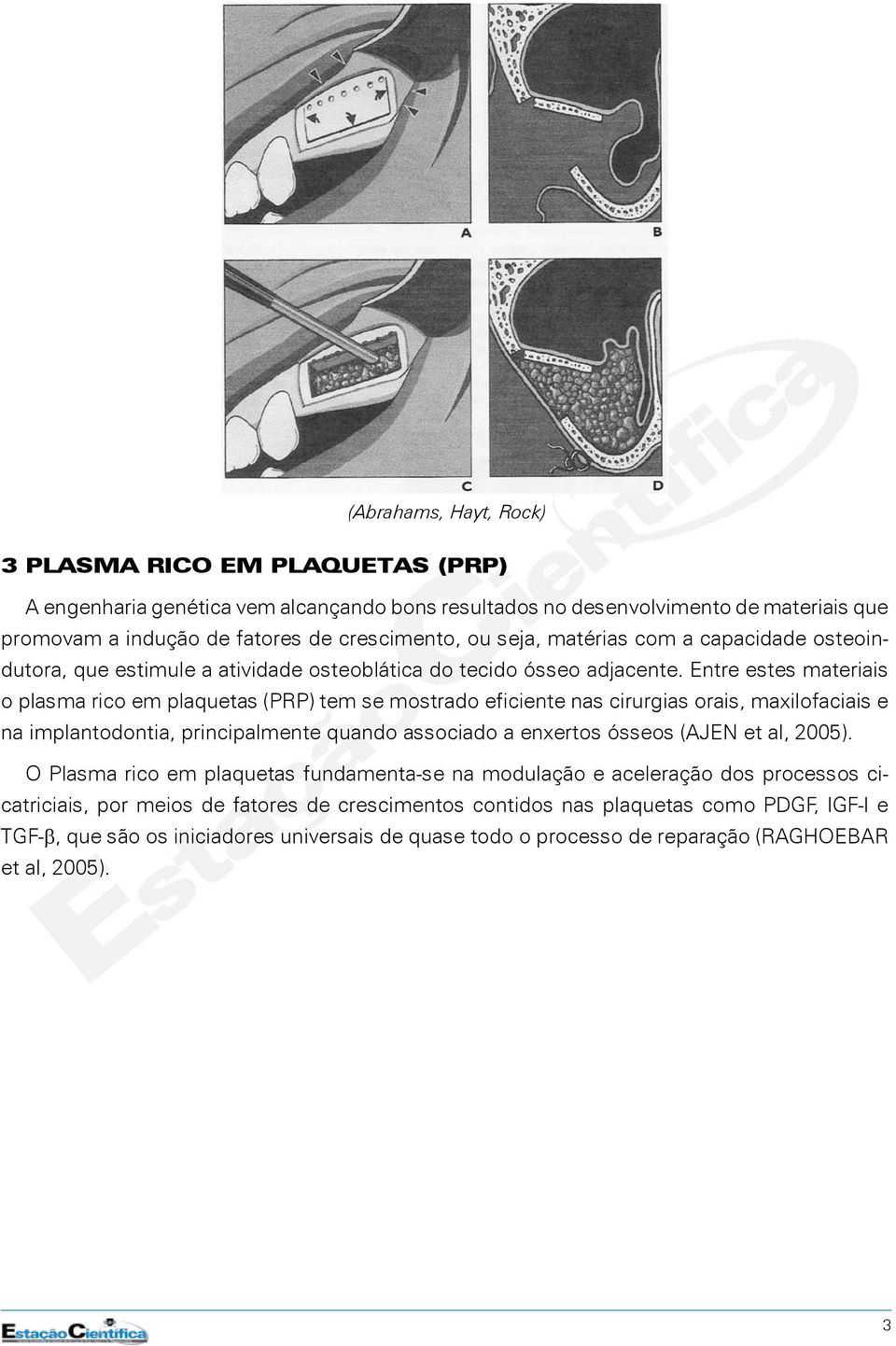 Entre estes materiais o plasma rico em plaquetas (PRP) tem se mostrado eficiente nas cirurgias orais, maxilofaciais e na implantodontia, principalmente quando associado a enxertos ósseos (AJEN et