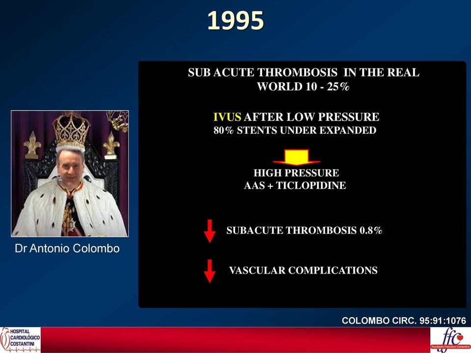 PRESSURE AAS + TICLOPIDINE Dr Antonio Colombo SUBACUTE