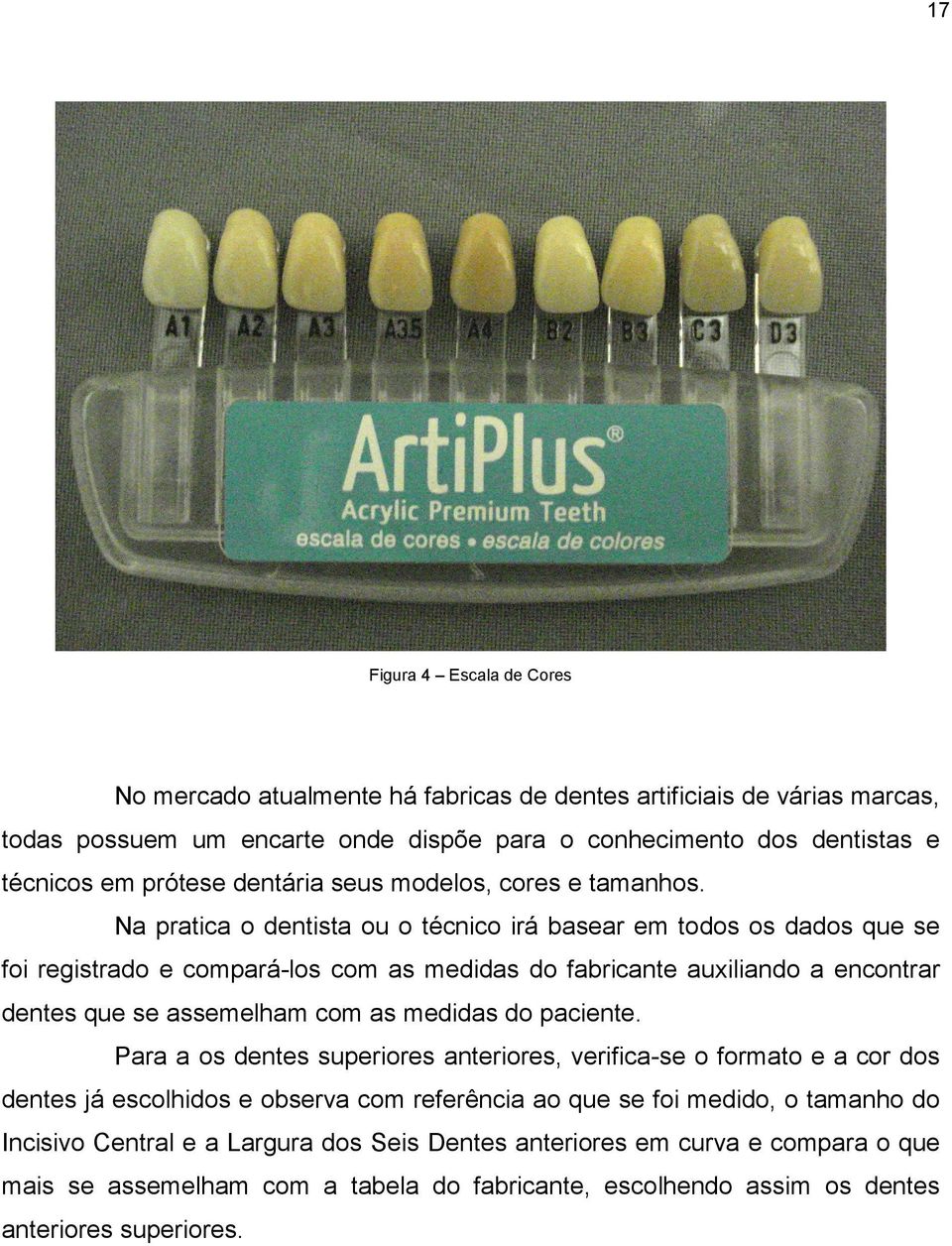 Na pratica o dentista ou o técnico irá basear em todos os dados que se foi registrado e compará-los com as medidas do fabricante auxiliando a encontrar dentes que se assemelham com as medidas