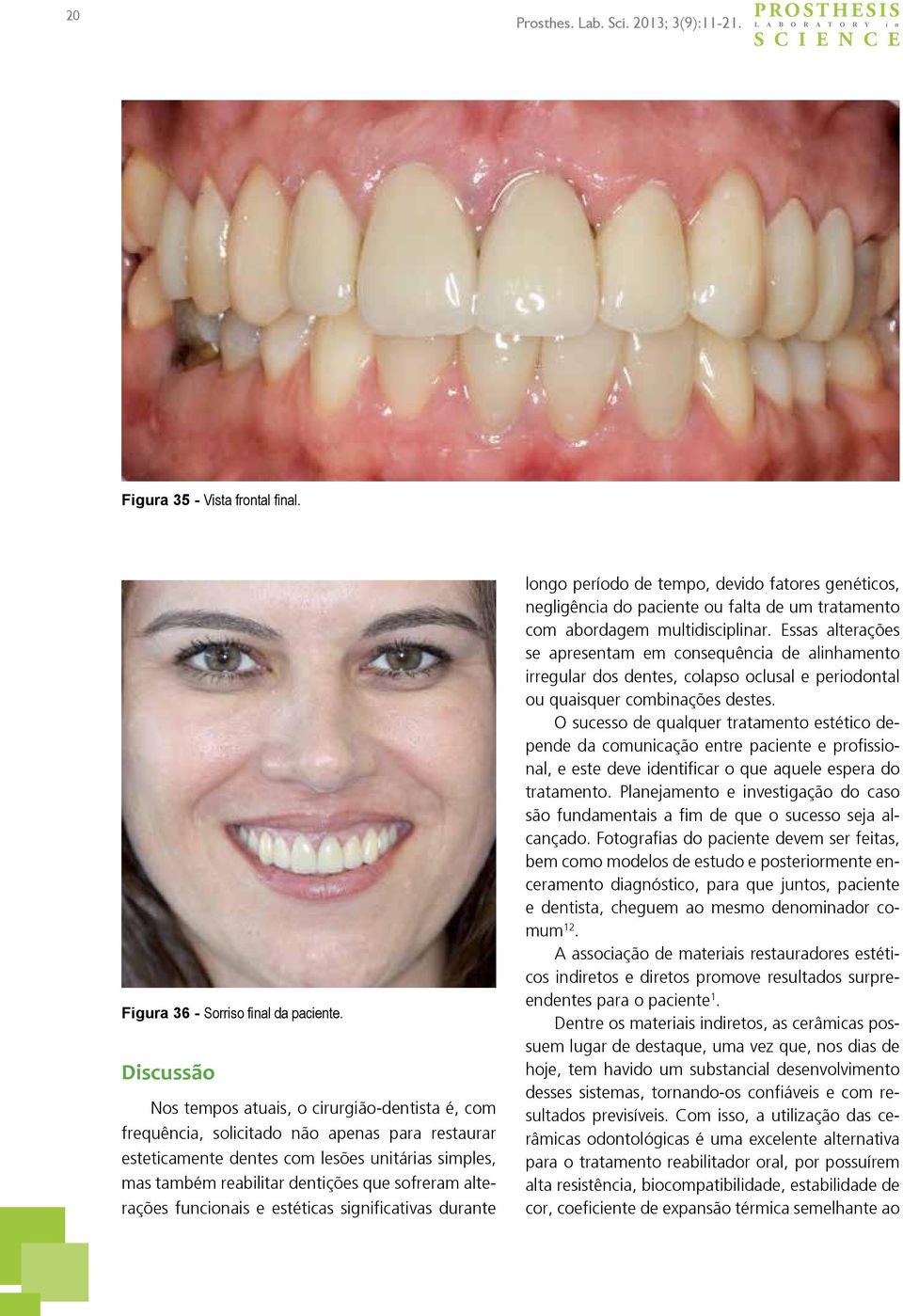 sofreram alterações funcionais e estéticas significativas durante longo período de tempo, devido fatores genéticos, negligência do paciente ou falta de um tratamento com abordagem multidisciplinar.