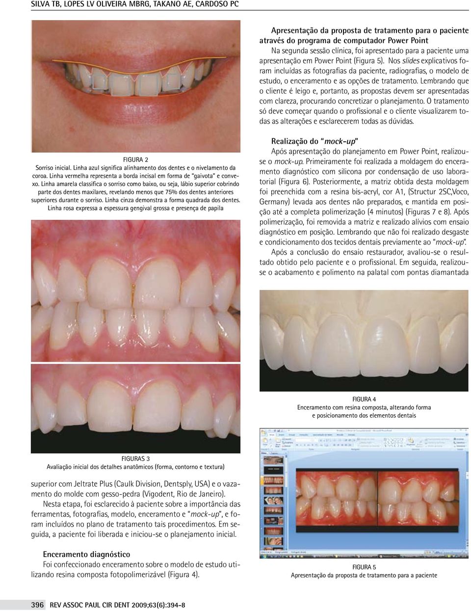 Nos slides explicativos foram incluídas as fotografias da paciente, radiografias, o modelo de estudo, o enceramento e as opções de tratamento.