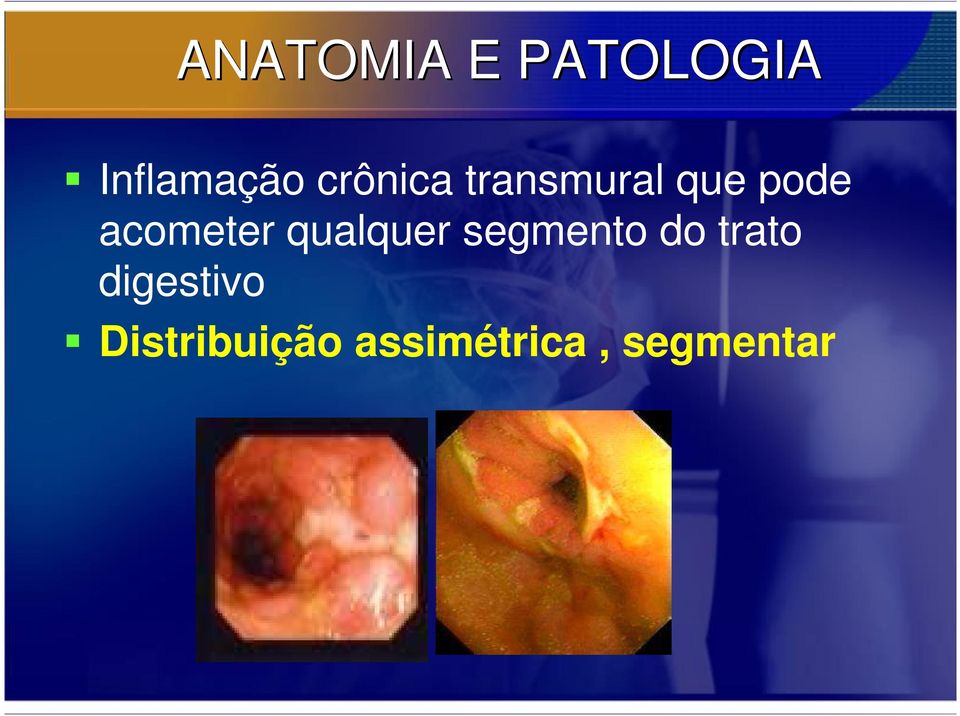 acometer qualquer segmento do trato